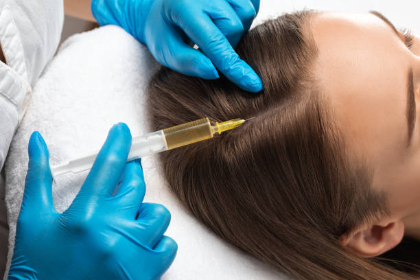 How PRP Helps Treat Hair Loss and Thinning Naturally