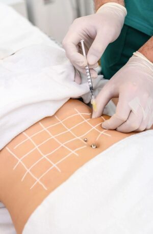Fat Melting Injections in Dubai
