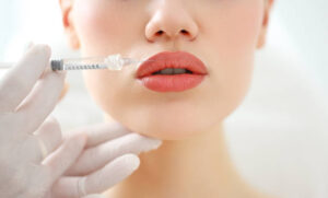 How to Prepare for Russian Lip Fillers