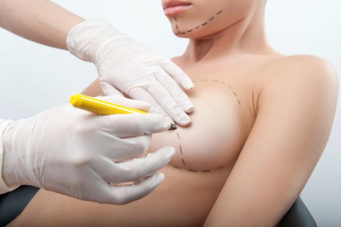 Innovative Breast Augmentation Techniques