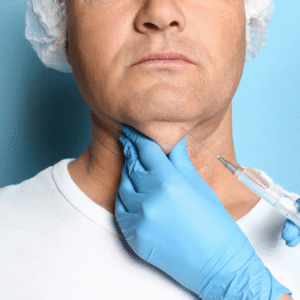 Kybella Treatment for Double Chin in Dubai