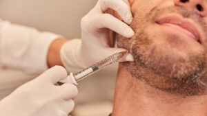 Jawline Contouring Solutions with Fillers