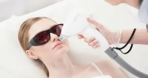 Laser Hair Removal in Dubai