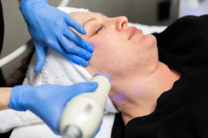 Melasma Treatment A Step Towards Clear Skin