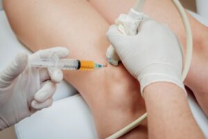 Regain Mobility with PRP Knee Therapy