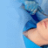 Rhinoplasty surgery in Dubai