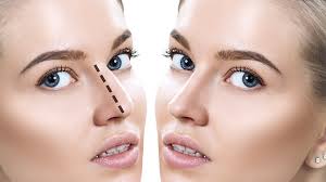 عملية تجميل الأنف في الرياض