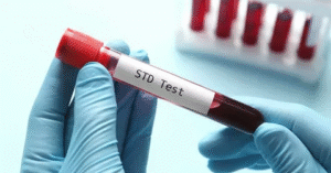 STD Test in Dubai
