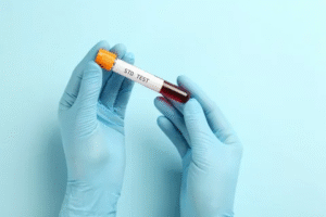 STD Test in Dubai