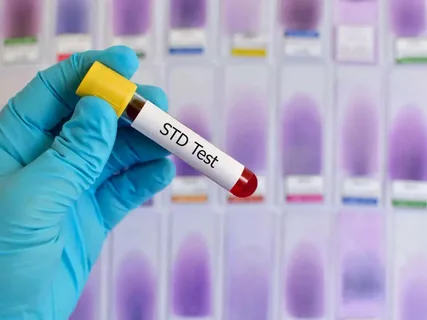 STD Test in Dubai