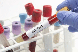 STD test in Dubai