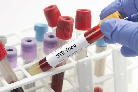 STD test in Dubai