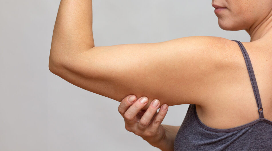 Say Goodbye to Sagging Skin with Arm Lift