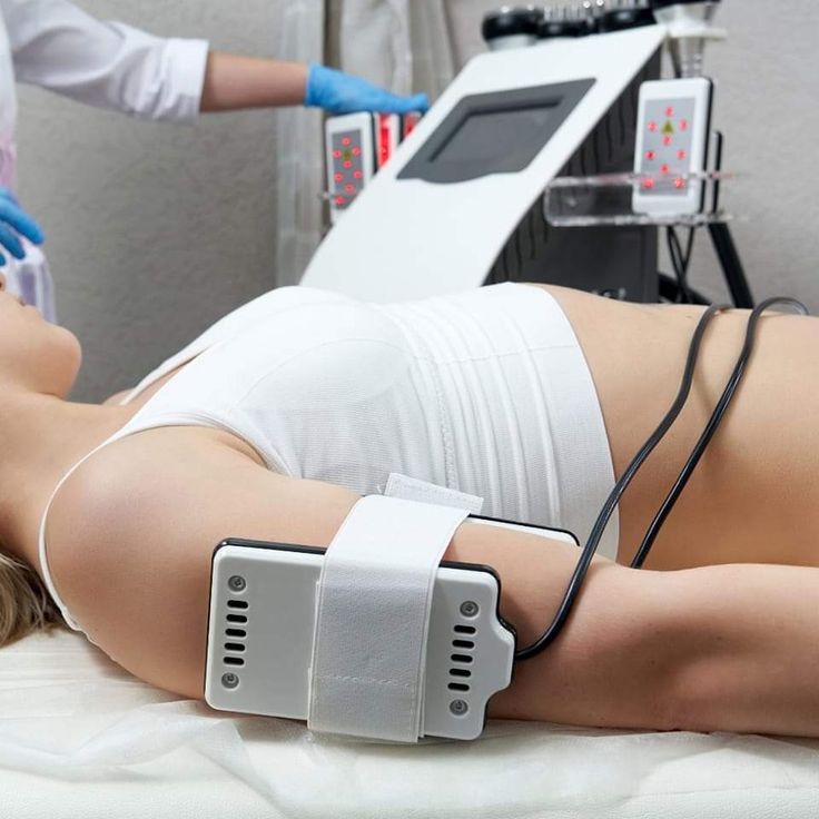 Step-by-Step Guide to Laser Liposuction