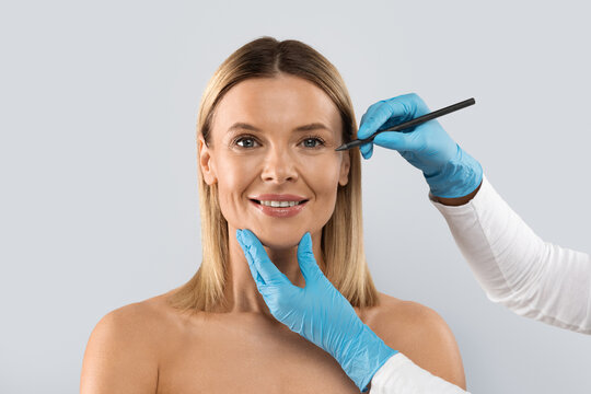 Blepharoplasty Dubai