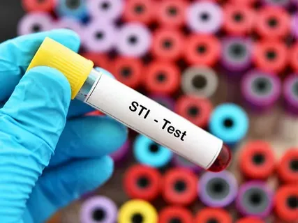 STD Test in Dubai