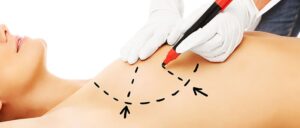 Achieve Your Desired Size with Breast Enlargement Injections