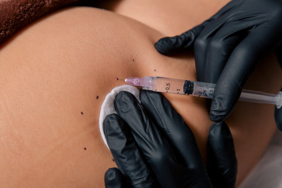 Achieve fuller, rounder buttocks naturally.