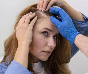 Advanced Hair Filler Treatments for Thinning Hair