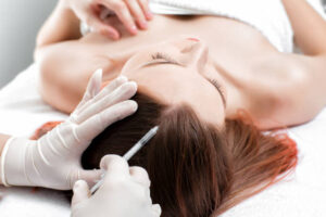 PRP Hair Treatment in Dubai