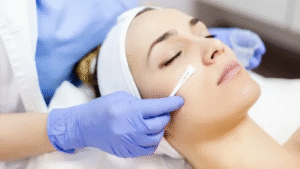 Chemical Peels in Dubai