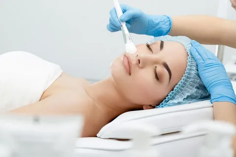 Chemical Peels in Dubai
