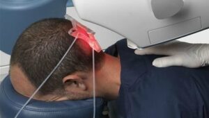 Does Robotic Hair Transplant Delivers Natural Results