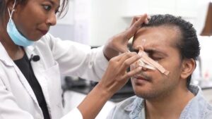Enhance Your Facial Features with Rhinoplasty