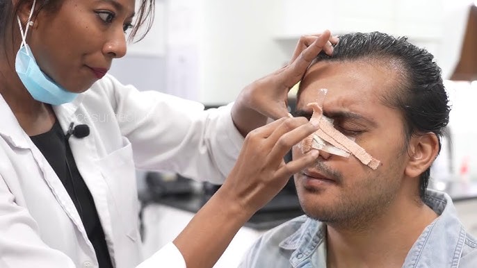 Enhance Your Facial Features with Rhinoplasty
