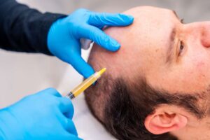Expert Surgeons Delivering Natural Results with FUE