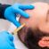 Expert Surgeons Delivering Natural Results with FUE