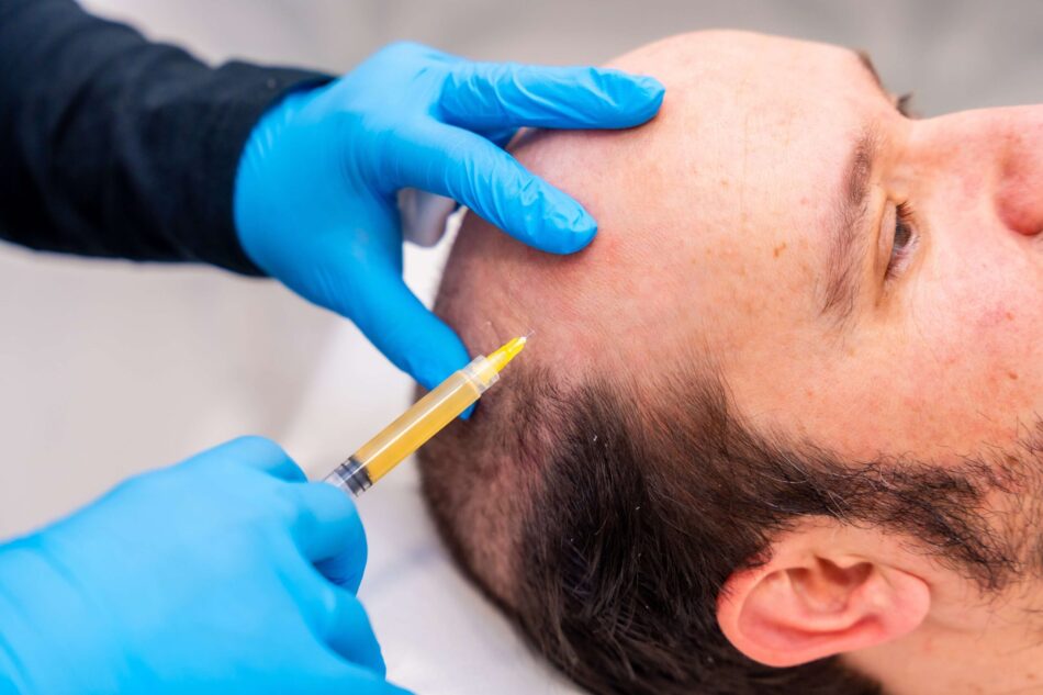 Expert Surgeons Delivering Natural Results with FUE
