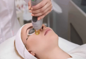 Fractional CO2 Laser Treatment in Dubai