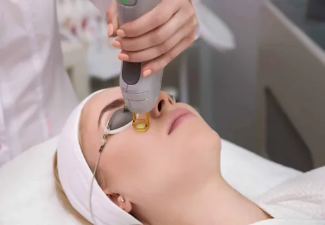 Fractional CO2 Laser Treatment in Dubai