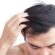 GFC Hair Treatment An Advanced PRP Alternative