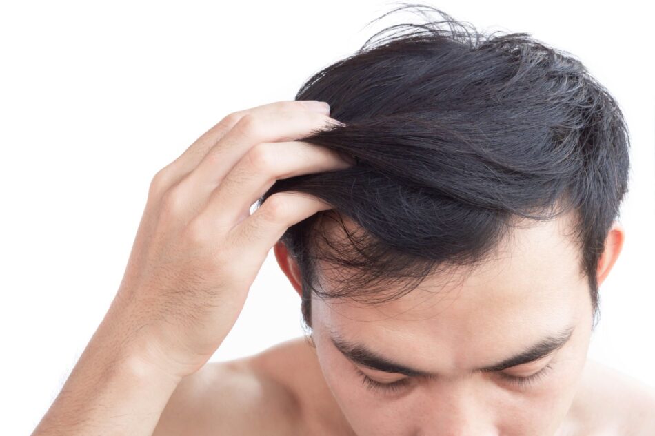 GFC Hair Treatment An Advanced PRP Alternative