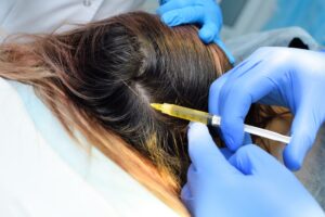 Hair Loss Treatments for a Healthy Scalp