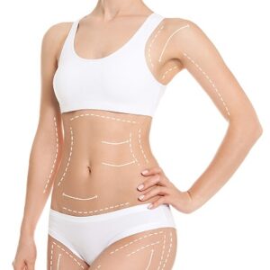 How BodyTite Liposuction Helps Reduce Stubborn Fat