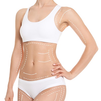 How BodyTite Liposuction Helps Reduce Stubborn Fat