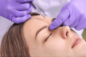 How Botox Restores Facial Expression After Palsy