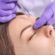 How Botox Restores Facial Expression After Palsy