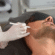 How Can Beard Laser Hair Removal Define Jawline Shape