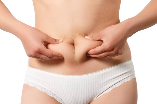 How CoolSculpting Targets Stubborn Belly Fat