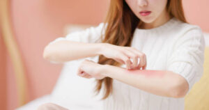 How Eczema Treatment Relieves Itchy, Irritated Skin