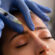 How Fillers Injections Enhance Facial Volume Fast