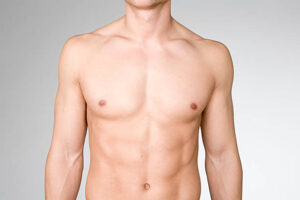 How Gynecomastia Surgery Improves Chest Shape