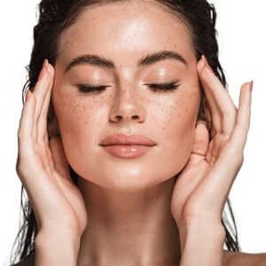 How Melasma Treatment Helps Fade Dark Skin Patches