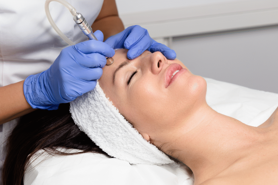 How Microdermabrasion Treatment Renews Your Glow