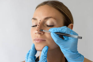 How Rhinoplasty Can Enhance Your Facial Harmony