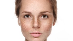 How to Choose the Right Pigmentation Treatment